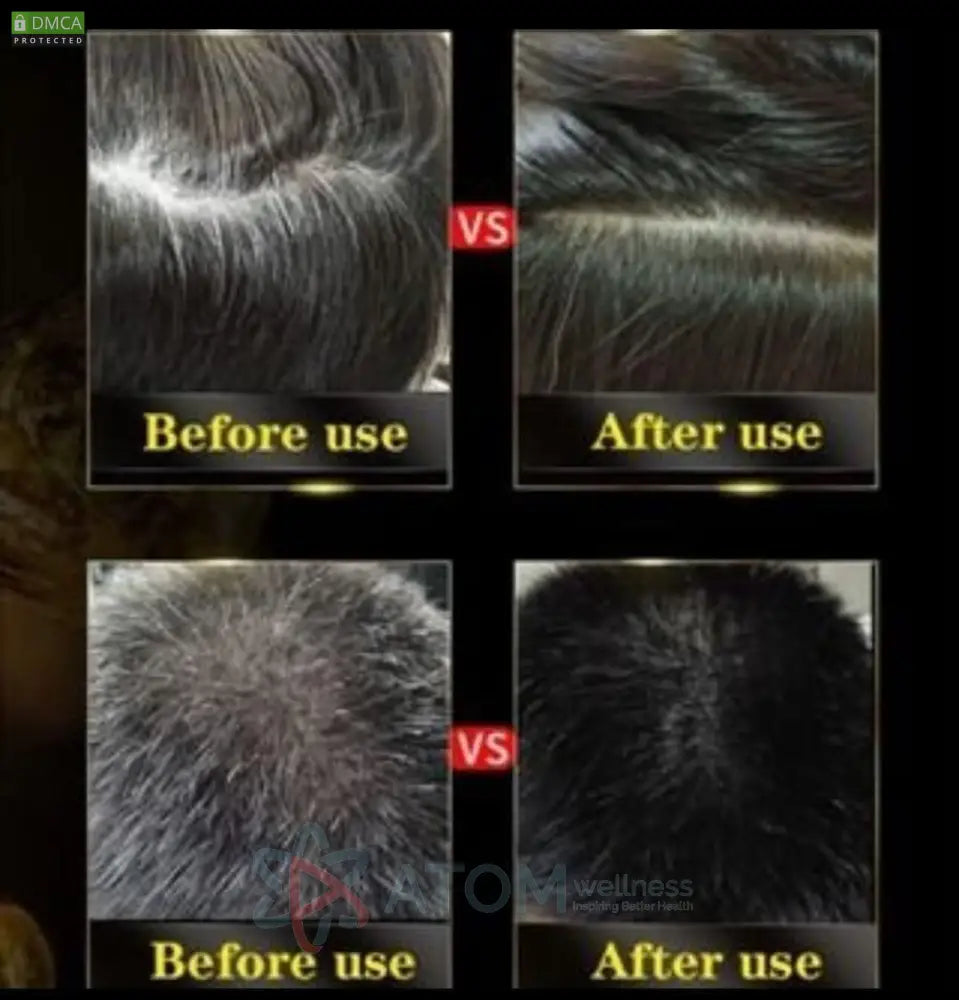 Unisex Instant Black Herbal Hair Dye Shampoo For Grey Coverage 3 In 1(100Ml) Pack Of 2