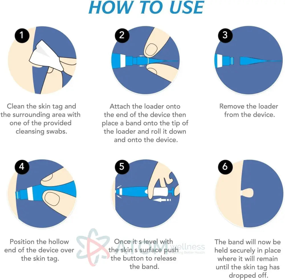 2 in 1 Skin Tag Remover Kit - Painless