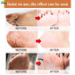 Foot Cream for Cracked and Dry Skin Heel Finger Healing Balm and Blaster 200 ml