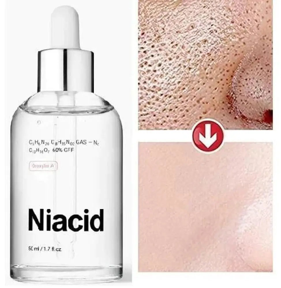 Niacid Dark Spot Removal Anti Acne Face Serum 30 Ml